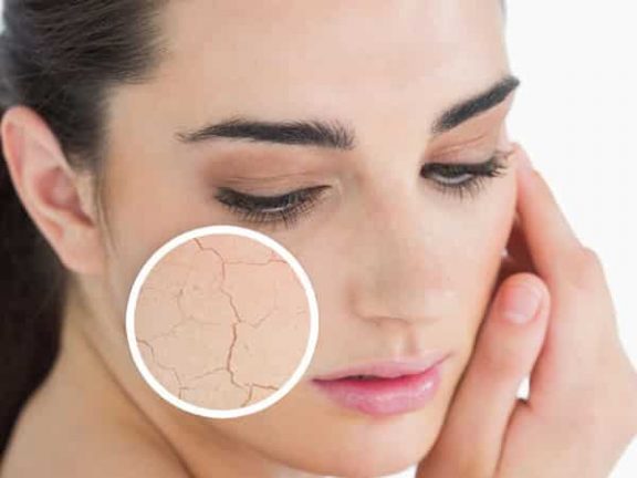 Maschera viso fatta in casa per pelle secca