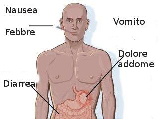 intossicazione alimentare sintomi