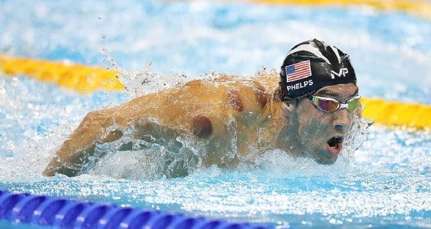 Cupping Michael Phelps