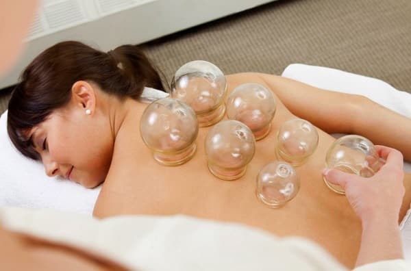 Cupping