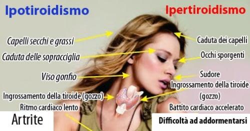 dieta dimagrante con tiroidite da hashimoto dieta dimagrante con tiroidite da hashimoto