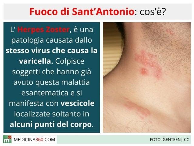 Fuoco di Sant'Antonio