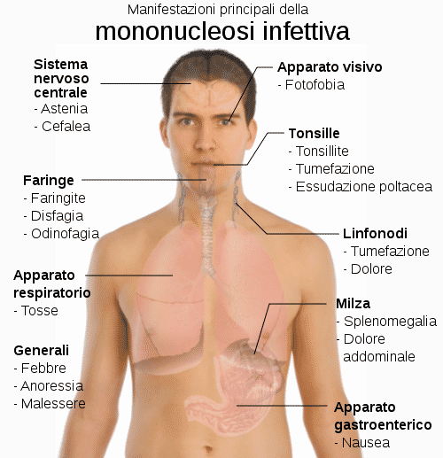 Mononucleosi sintomi