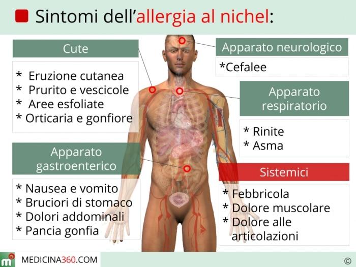 Allergia al nichel sintomi