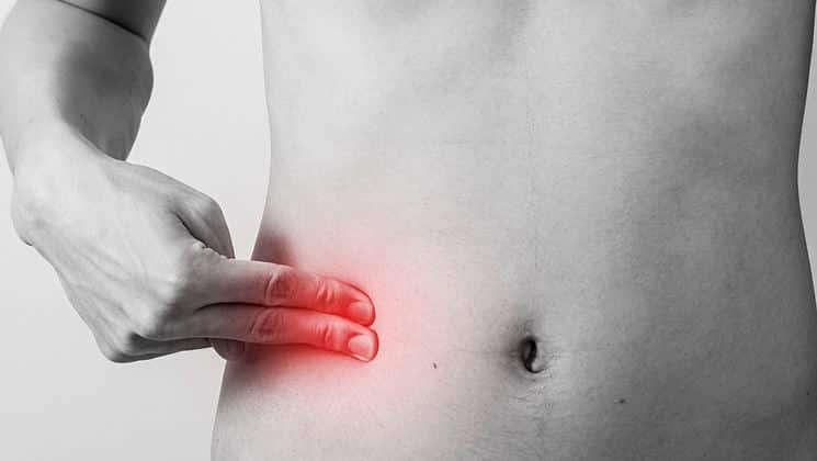 Come Capire Se è Appendicite O Colite