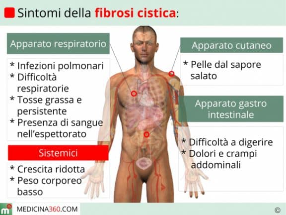 Fibrosi cistica