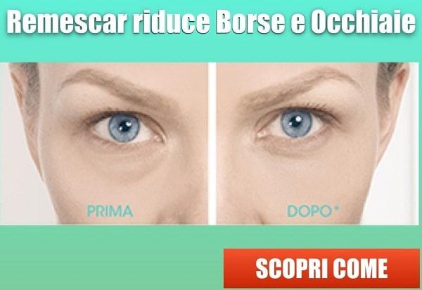 Remescar Borse e Occhiaie