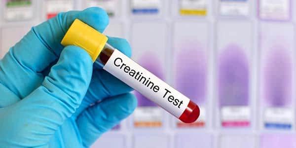 Creatinina alta