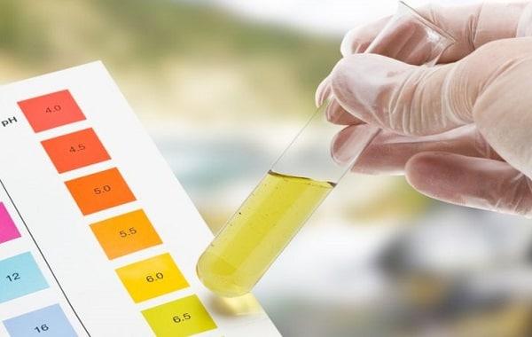 sangue nelle urine
